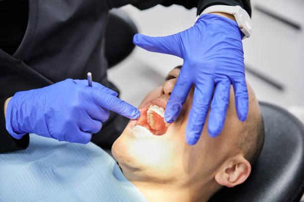 Best Urgent Care for Lost Fillings or Crowns in San Antonio, TX